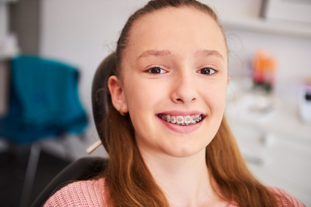 Invisalign : Everything You Need to Know About Clear Braces