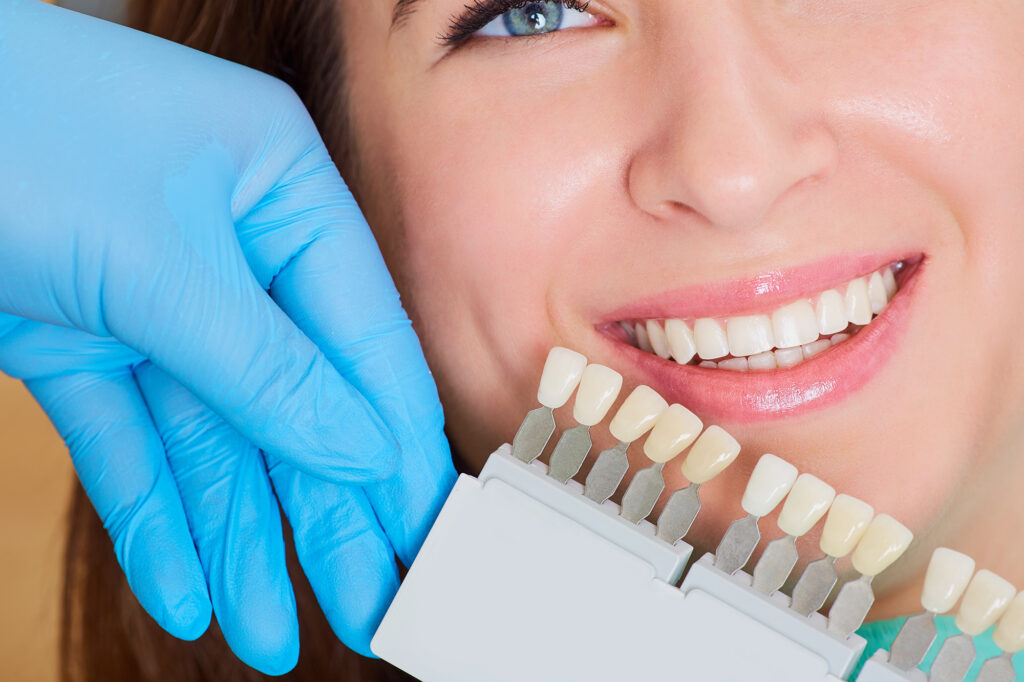 Dental Crowns at Torrance Smile Dental: Everything You Need to Know